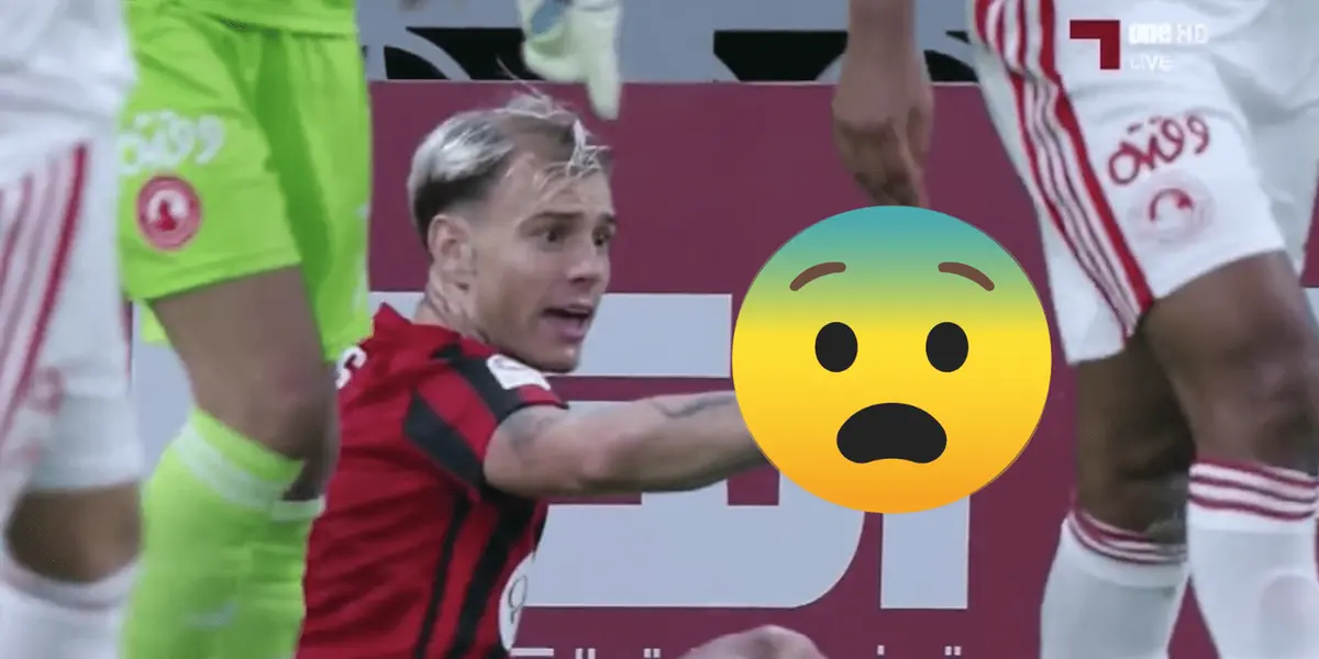 Ex-jogador do Corinthians teve uma fratura no dedo durante a partida